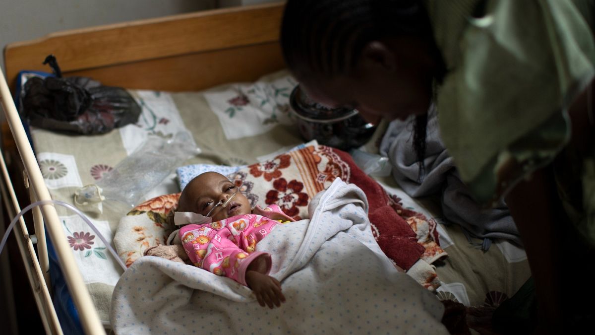 Malnourished baby Mebrhit, who at 17 months old weighs just 5.2kg (11lbs 7oz), being cared for by her mother Birhan Etsana, at a Tigray hospital on May 10, 2021