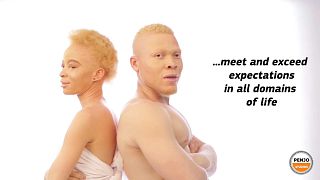 Cameroonian actress Memba shines light on persons with albinism 