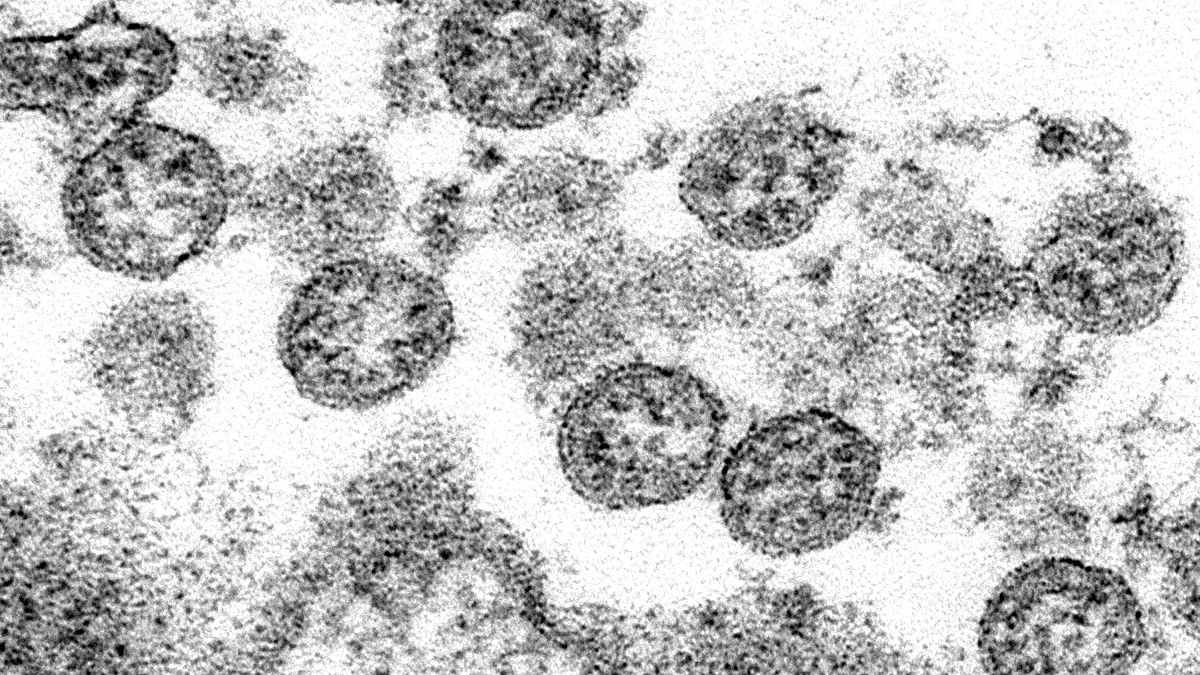 صورة لجزيئات فيروس كورونا تحت المجهر الإلكتروني  في المركز الأمريكي لمكافحة الأمراض والوقاية منها.