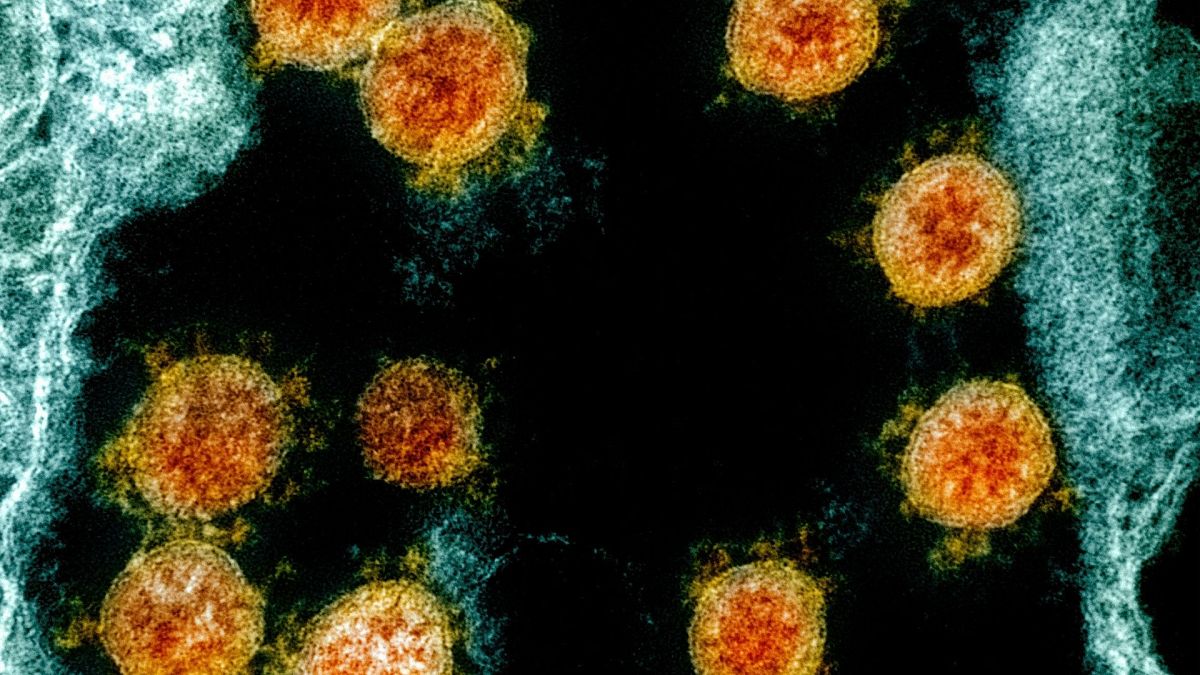عکس میکروسکوپی از سلول‌های آلوده شده به ویروس کرونا