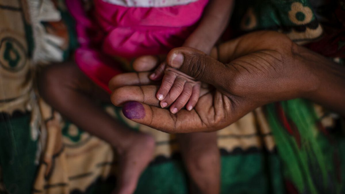Foto de una madre con su hija malnutrida en un hospital de Tigray, Etiopía
