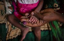 Foto de una madre con su hija malnutrida en un hospital de Tigray, Etiopía