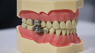 Dişe takılarak zayıflamaya yardımcı olan alet - DentalSlim Diet Control
