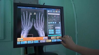 Un médico ruso abre puertas y paga en los comercios con sus chips implantados en las manos