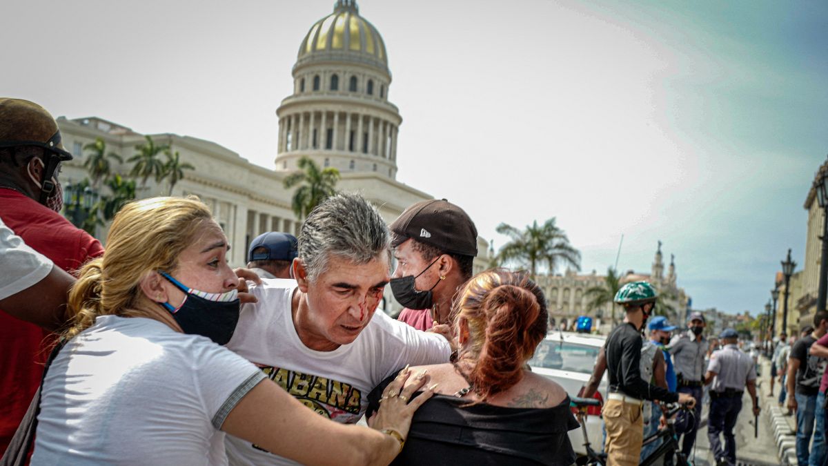 Un manifestante herido en la protesta contra el Gobierno cubano en La Habana