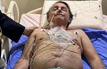 Bélelzáródással került kórházba Jair Bolsonaro