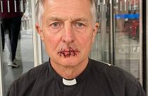 A priest has sewn his lips together to protest against the alleged lack of climate coverage in Rupert Murdoch's media empire.