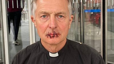 A priest has sewn his lips together to protest against the alleged lack of climate coverage in Rupert Murdoch's media empire.