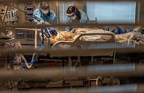 Paciente con COVID-19 dentro de la UCI del Centro Médico Sutter Roseville en Roseville, California, el martes 22 de diciembre de 2020