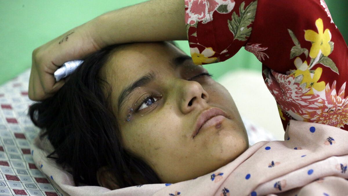 An Afghan girl receives medical care at the International Committee of the Red Cross (ICRC) physical rehabilitation center after being injured in fighting between the Taliban 