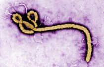 Ebola virüsü