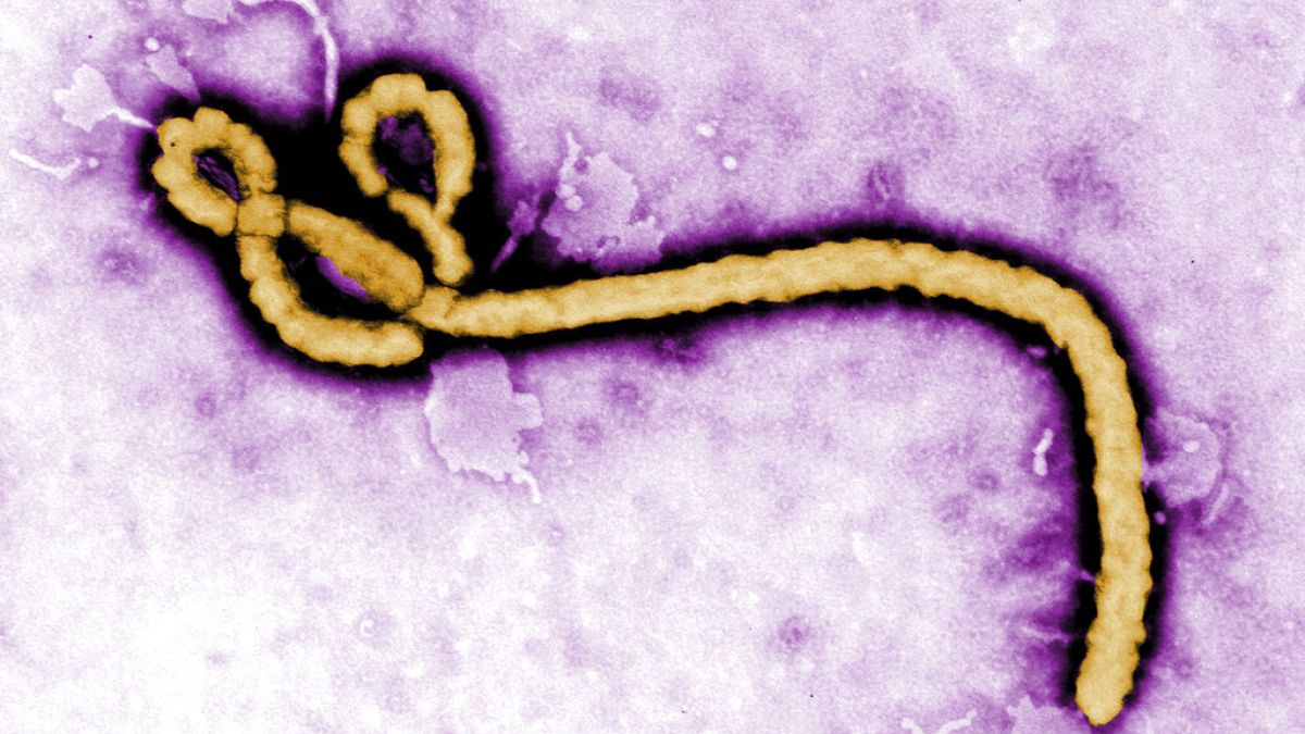 صورة مجهرية إلكترونية ملونة أتاحتها مراكز السيطرة على الأمراض والوقاية منها  تُظهر فيروس إيبولا
