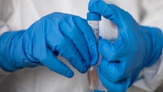 Βρετανία: Στοπ στις εξετάσεις αίματος λόγω... έλλειψης δοκιμαστικών σωλήνων