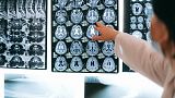 Algorithm developed by Lithuanian researchers can predict possible Alzheimer’s with nearly 100 per cent accuracy