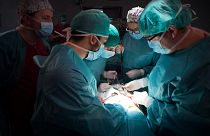 يقوم الجراح ماريو ألفاريز مايسترو (يمين) ومعاونيه بإجراء عملية زرع كلى للمريض خوان بينيتو درويت في مستشفى لاباز في مدريد، إسبانيا، 28 فبراير 2017