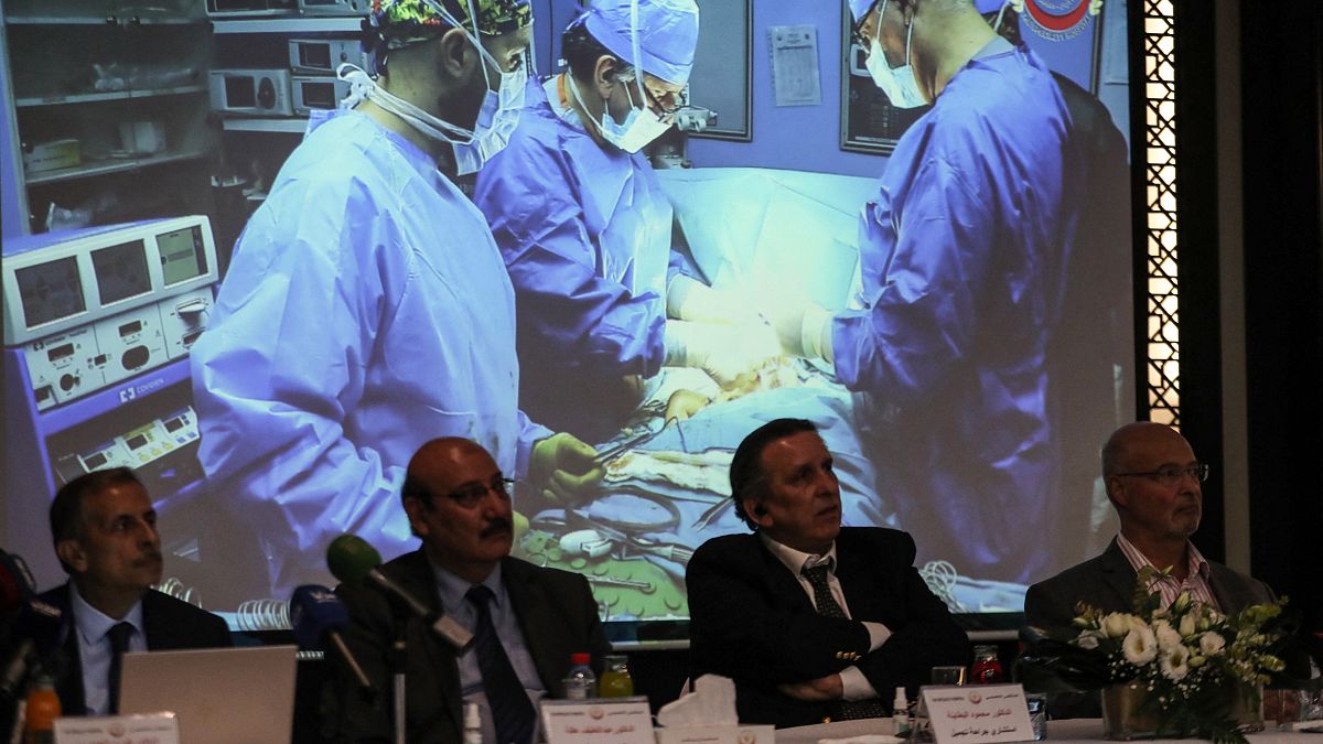 أعلن أعضاء فريق طبي أردني أنهم أجروا عملية نادرة استغرقت ثماني ساعات لفصل توأمين ملتصقين يمنيين ، الصيف الماضي ، خلال مؤتمر صحفي في العاصمة الأردنية عمان ، في 3 أكتوبر 2021.