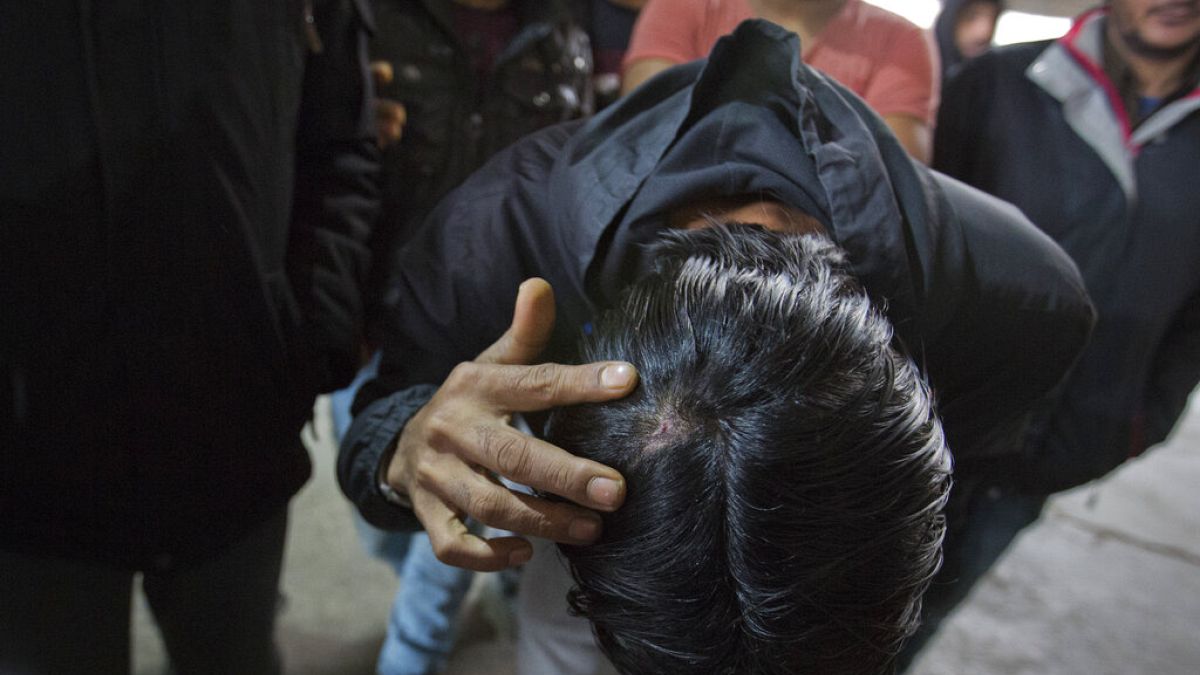 A migrant who claims he was beaten by Croatian police while attempting to cross the border to Croatia shows his injury in Bihac, Bosnia-Herzegovina, Wednesday, March 13, 2019
