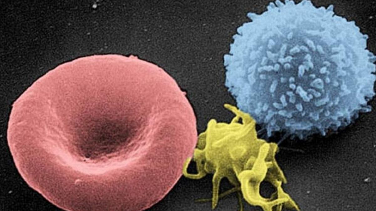 کشف جدید محققان دانشگاه تل‌آویو در مورد سلول‌های سرطانی 