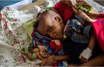 الطفل جبري كيدان جبريهيوت (عامان) أثناء علاجه من سوء التغذية في مستشفى أيدر في ميكيلي، في منطقة تيغراي بشمال إثيوبيا 6 أيار/مايو 2021