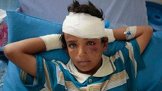 یک کودک زخمی در بیمارستانی در صعده یمن