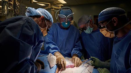 A surgical team at the hospital in New York examines a pig kidney attached to the body of a brain-dead recipient for any signs of rejection.