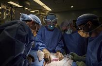 ΗΠΑ: Πρώτη μεταμόσχευση νεφρού από γουρούνι σε άνθρωπο