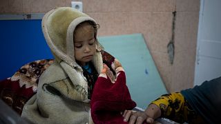 Yetersiz beslenme nedeniyle Kabil'de hastaneye yatırılan iki yaşındaki Güldane