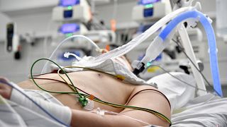 Medical equipment is seen as a patient lies in his bed on an intensive care unit (ICU) at a hospital of the Salzburg state clinics in Salzburg, Austria, on November 17, 2021