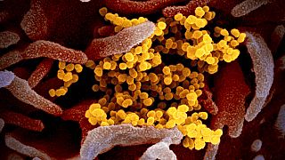 Koronavirüsün mikroskop görüntüsü (Arşiv)