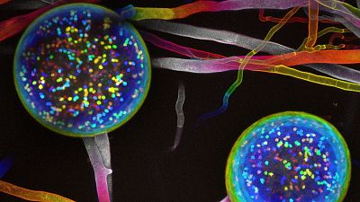 Fungal networks are being mapped for the first time. Image shows the reproductive spores containing nuceli. Fungal networks are being mapped for the first time. Image shows the reproductive spores containing nuceli.