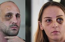 Violence conjugale entre judokas : la justice accusée de laxisme