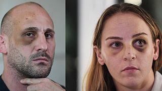 Judoca francesa acusa companheiro e treinador de agressão