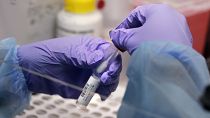 Биохимики и биоинженеры разрабатывают новые средства для определения штаммов коронавируса в образцах биоматериалов пациентов.