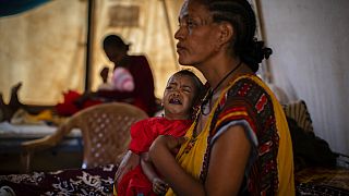 Roman Kidanemariam, 35, lányával, a 22 hónapos, súlyosan alultáplált Merkab Atakltival ellátásra várnak egy sátorban Etiópiában, a Tigray régióban