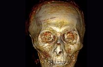 Mısır'da 3500 yıllık mumyanın tomografisi çekildi