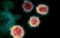 صورة الفيروس المسبب بكوفيد-19 تحت المجهر الإلكتروني في معهد الصحة الوطنية الأمريكية.