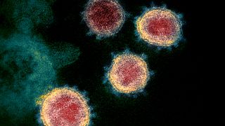 صورة الفيروس المسبب بكوفيد-19 تحت المجهر الإلكتروني في معهد الصحة الوطنية الأمريكية.