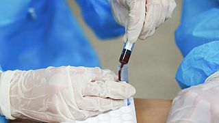 Kan testleri kanserin erkenden teşhisine yardımcı olabilecek