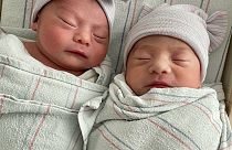 Doğum yılları farklı ikizler Alfredo ve Aylin