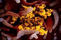 ABD Ulusal Sağlık Enstitüleri tarafından elektron mikroskobu ile çekilen Koronavirüs SARS-CoV-2 görüntüsü