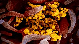 ABD Ulusal Sağlık Enstitüleri tarafından elektron mikroskobu ile çekilen Koronavirüs SARS-CoV-2 görüntüsü