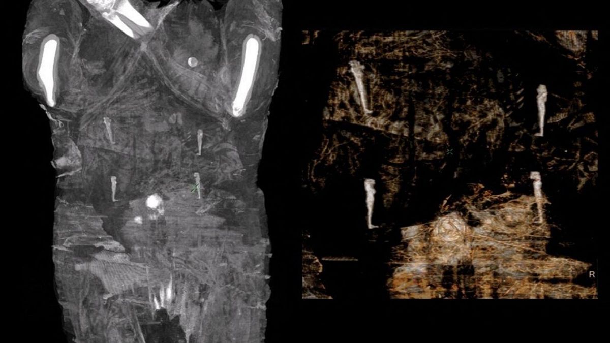 تصاویربرداری با اشعه ایکس از مومیایی باردار مصری