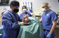 أعضاء الفريق الجراحي يعرضون قلب الخنزير لزرعه للمريض ديفيد بينيت في بالتيمور يوم الجمعة 7 يناير 2022.