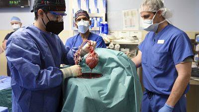 Members of the surgical team at the University of Maryland School of Medicine show the pig heart for transplant into patient David Bennett, Baltimore, Jan. 7, 2022.