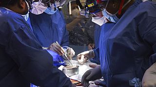 Première médicale mondiale : un cœur de cochon greffé sur un patient américain de 57 ans