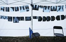  X-rays hang in a tent that is part of a protest camp in Warsaw, Poland