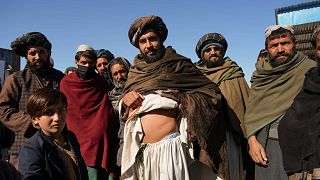 Afganistan'da geçinmek için böbreğini satmak zorunda kalan Sardar Muhammad