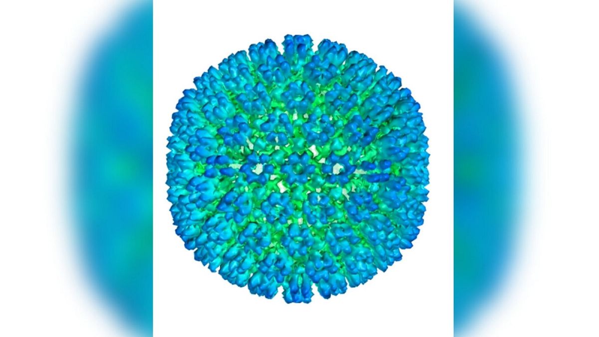 شناسایی ویروس اپشتین–بار به عنوان منشاء بیماری «ام اس»