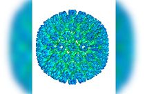 شناسایی ویروس اپشتین–بار به عنوان منشاء بیماری «ام اس»
