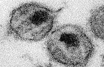 HIV'in elektron mikroskobu görüntüsü (Arşiv)